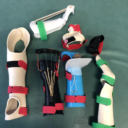 Advanced Splinting